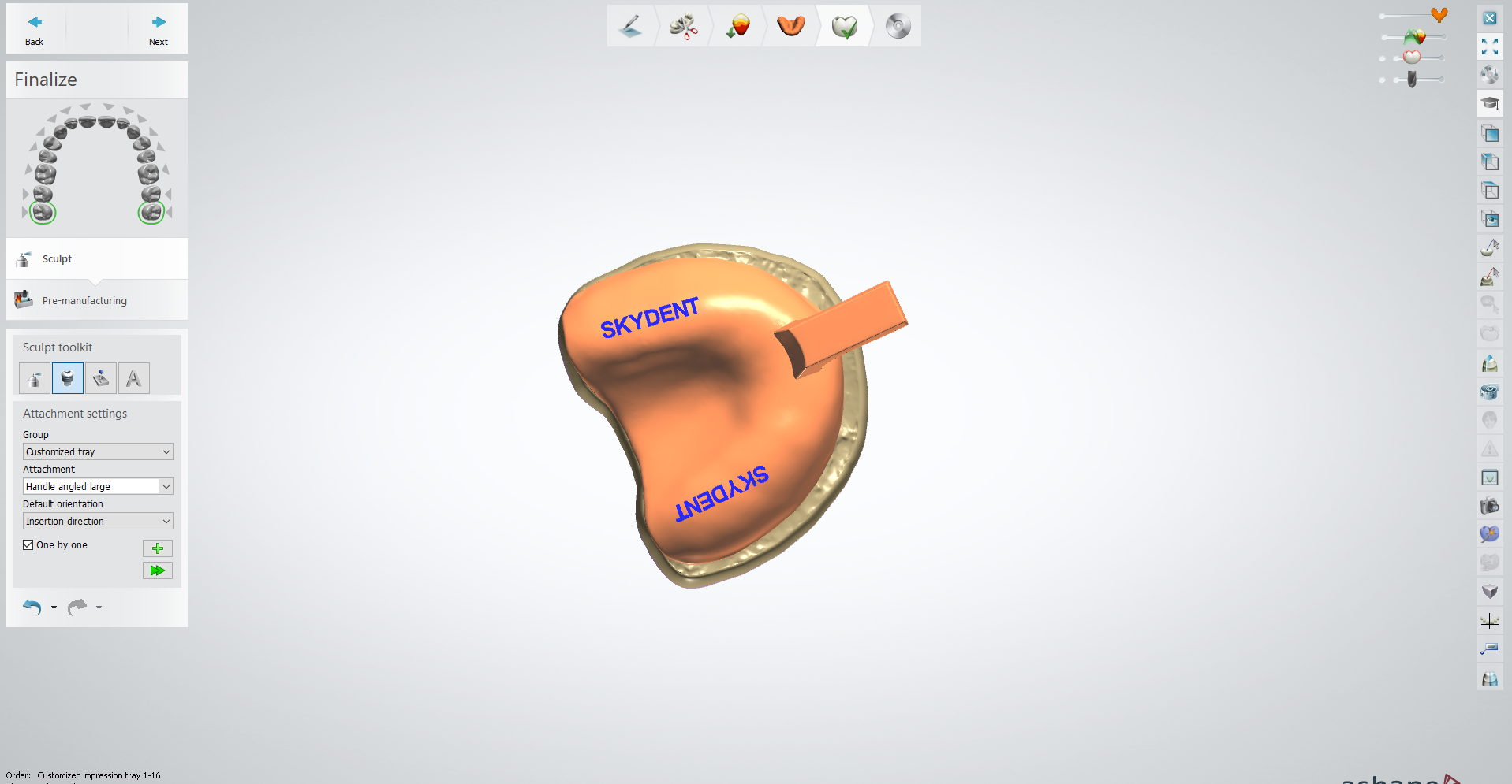 Customized dental tray design for dental labs